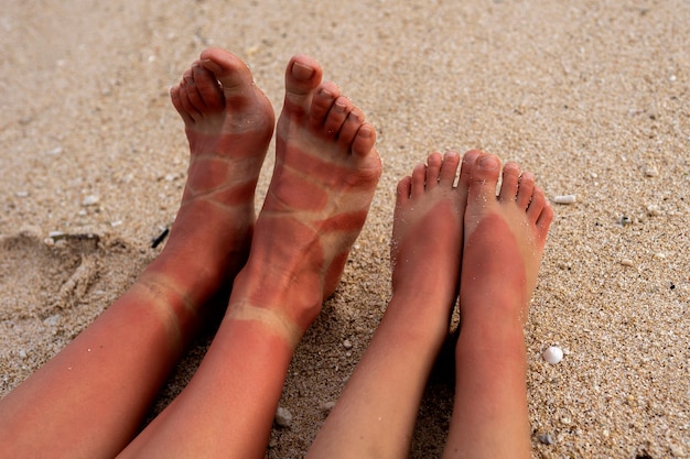 Vista dei piedi delle scottature solari di una donna e di un bambino indossando sandali in spiaggia