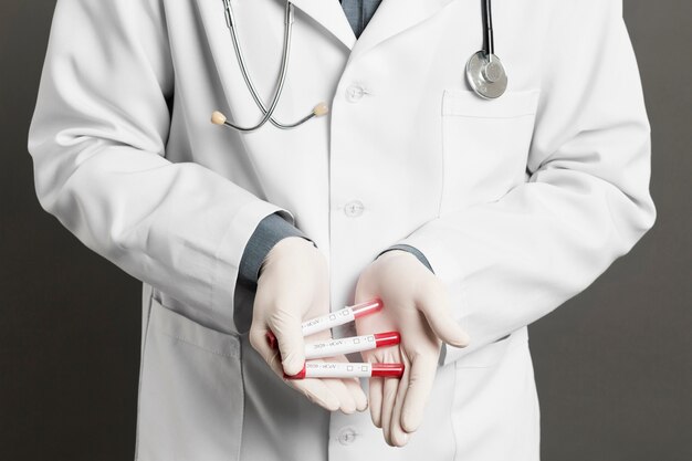 Vista frontale del medico con guanti chirurgici in possesso di vacutainer