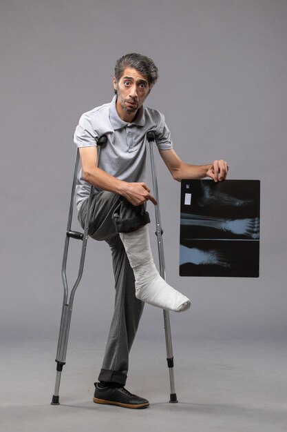 Vista frontale giovane maschio con piede rotto usando le stampelle e tenendo la sua radiografia sul dolore da scrivania grigio disabilitare la gamba rotta incidente piede