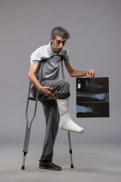 Vista frontale giovane maschio con piede rotto usando le stampelle e tenendo la sua radiografia sul dolore del muro grigio disabilitare le gambe piede rotto incidente