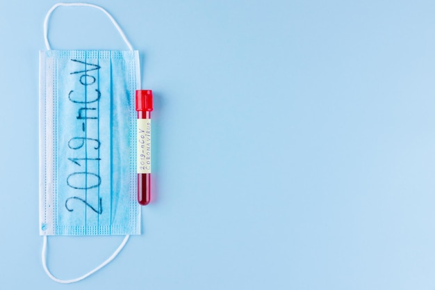 2019nCoV tubo di prova con sangue identificato dal coronavirus 2019nCoV su blu