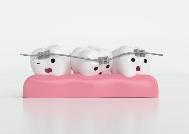 3d de dientes tristes con problema estetico sobre encias