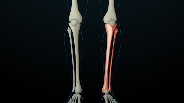 3d reso illustrazione della struttura dello scheletro con ossa ferite. Il dolore osseo è mostrato da un bagliore rosso. Dolore nella sezione delle gambe.