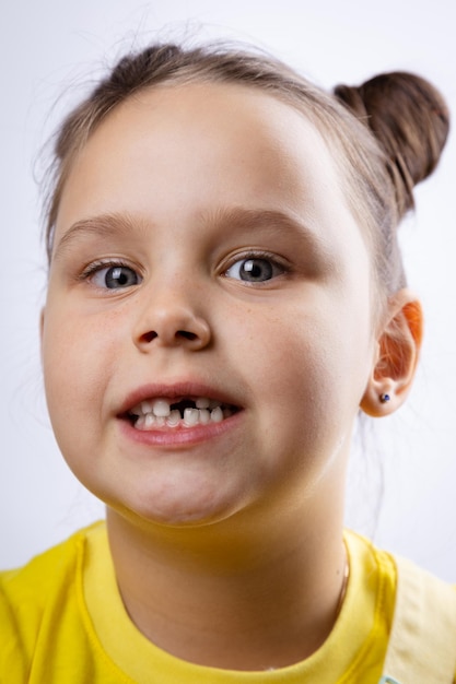 Affascinante faccia di capretto femminile con la bocca aperta che mostra il dente da latte anteriore mancante in maglietta gialla su sfondo bianco Primi denti che cambiano Andare dal dentista per fare il trattamento dei denti