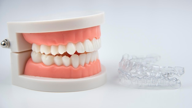 Aligners invisibili e rimovibili per l'allineamento dei denti