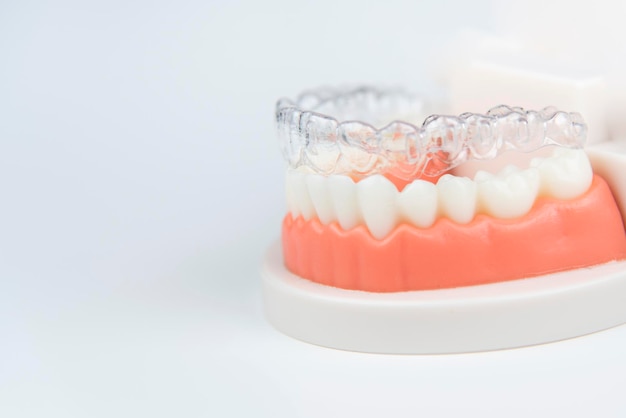 Aligners invisibili e rimovibili per l'allineamento dei denti