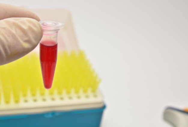 Analisi del sangue nei laboratori diagnostici clinici