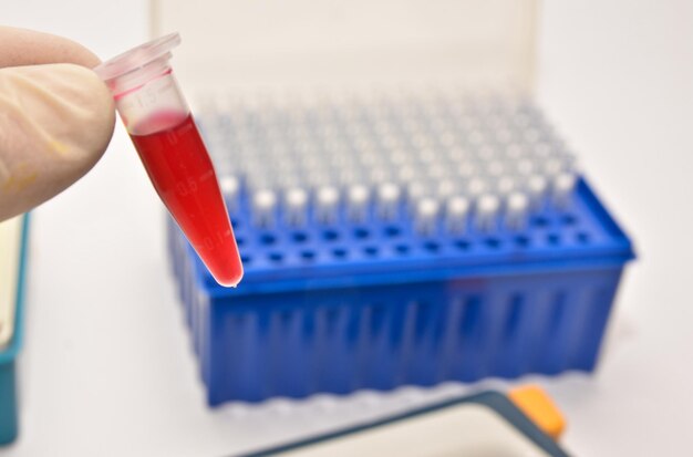 Analisi del sangue nei laboratori diagnostici clinici