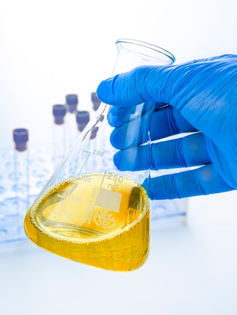 Analisi delle urine in laboratorio. Esame medico delle urine. Campione di urina per analisi di laboratorio