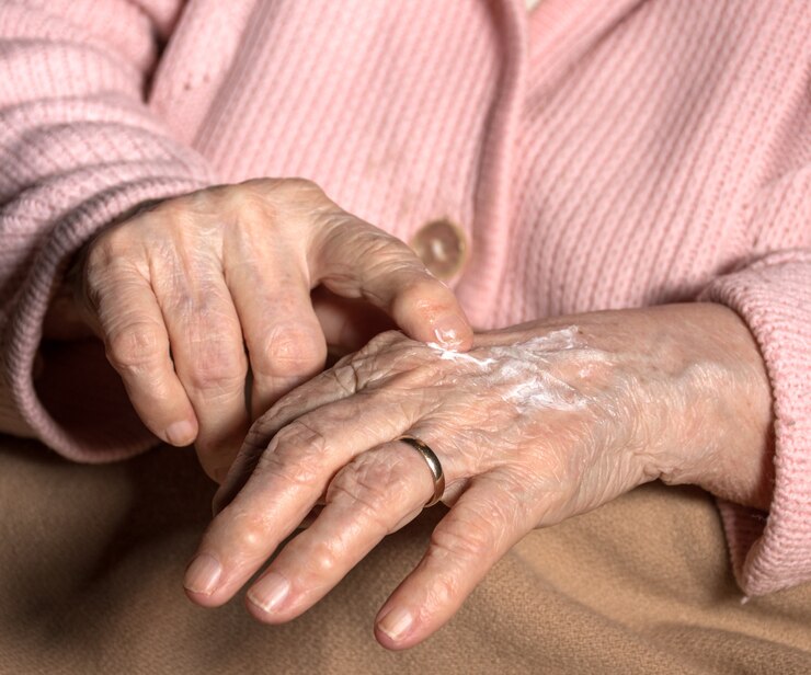 Anziana che applica la crema per le mani a casa. Primo piano delle mani della donna rugosa