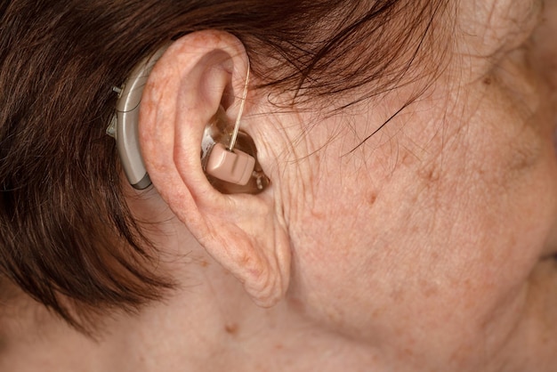 Apparecchio acustico nell'orecchio della donna anziana - foto del primo piano