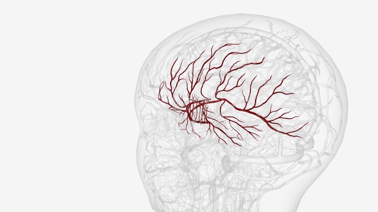 Foto arteria cerebrale media sinistra e rami