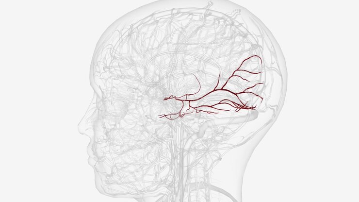 Foto arteria cerebrale posteriore sinistra e rami