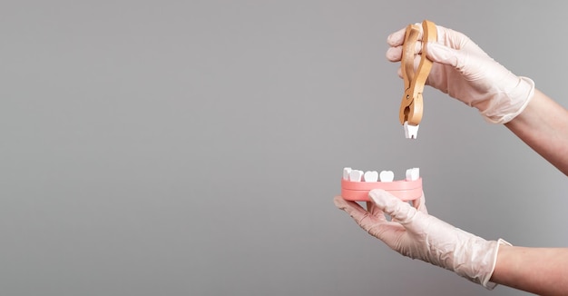 Banner con le mani del dentista che tirano il dente con il forcipe fuori dal modello della mascella Concetto di stomatologia di estrazione dei denti Trattamento delle malattie dentali Spazio di copia