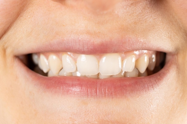 Bel sorriso femminile con il primo piano dei denti dritti