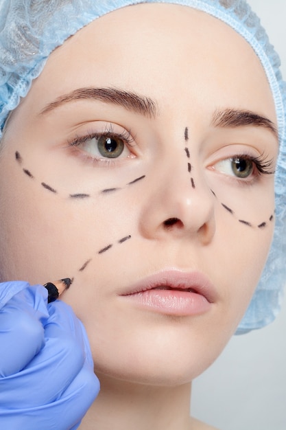Bella giovane donna con linee di perforazione sul viso prima dell'operazione di chirurgia plastica