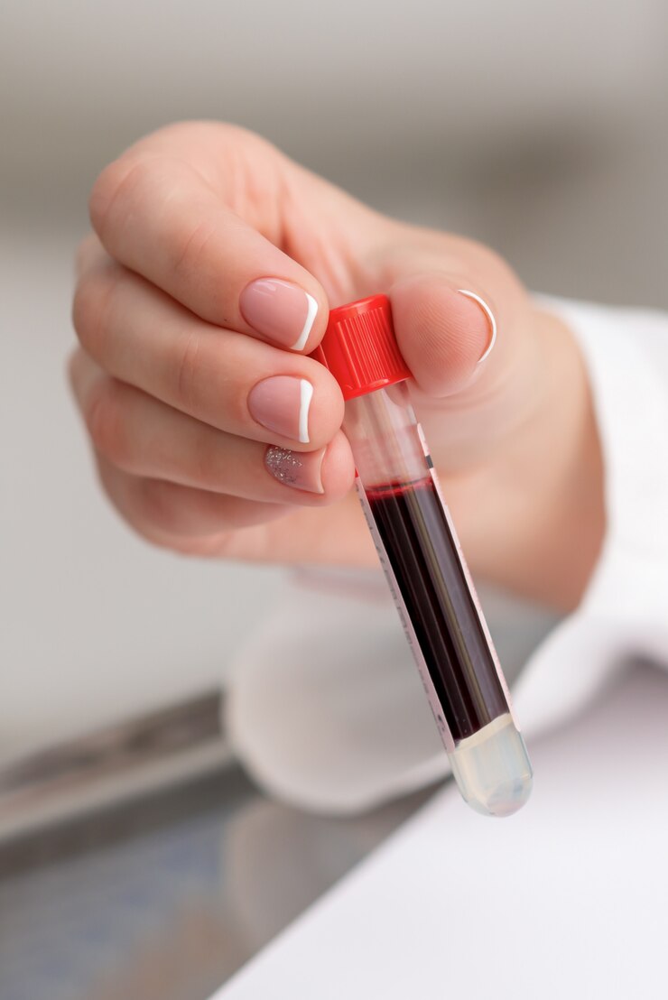 Blood sample tubes in hands.
