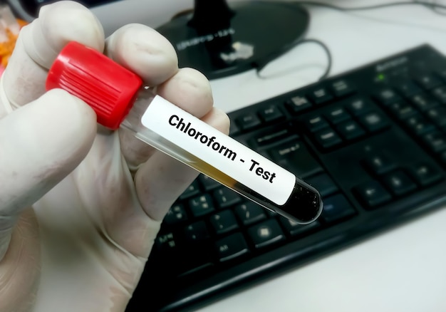 Campione di sangue per il test del livello di cloroformio