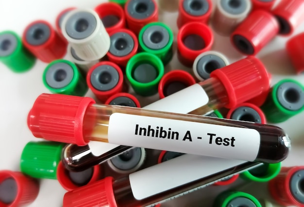 Campione di sangue per il test dell'inibina A