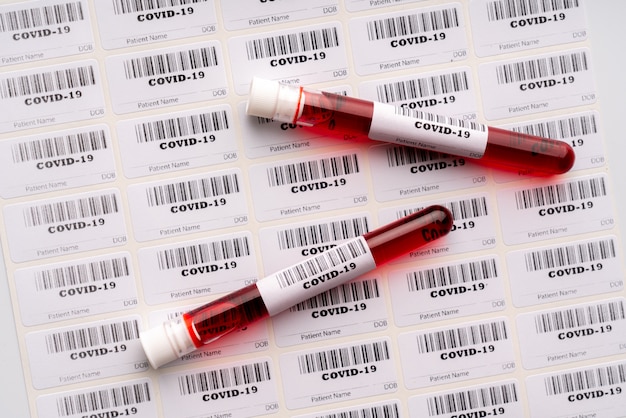 Campioni di analisi del sangue con codici a barre