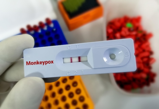 Cassetta per test rapido per il test del virus Monkeypox