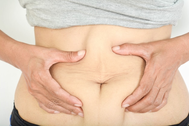 Cellulite sulla pancia grassa.