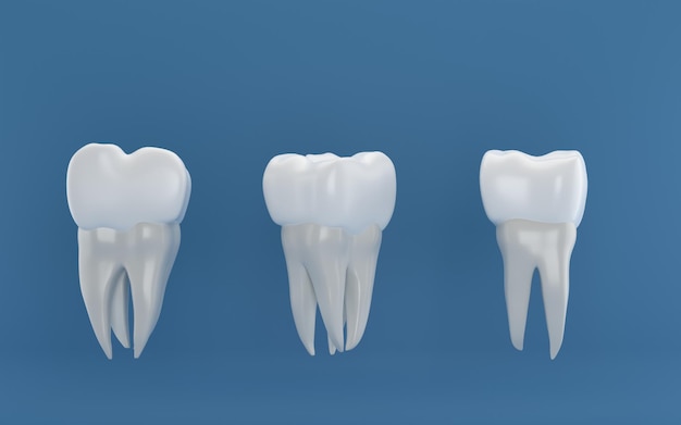 Chirurgia degli impianti dentali rendering 3d