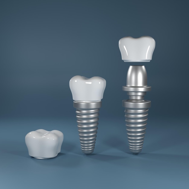 Chirurgia degli impianti dentali rendering 3d