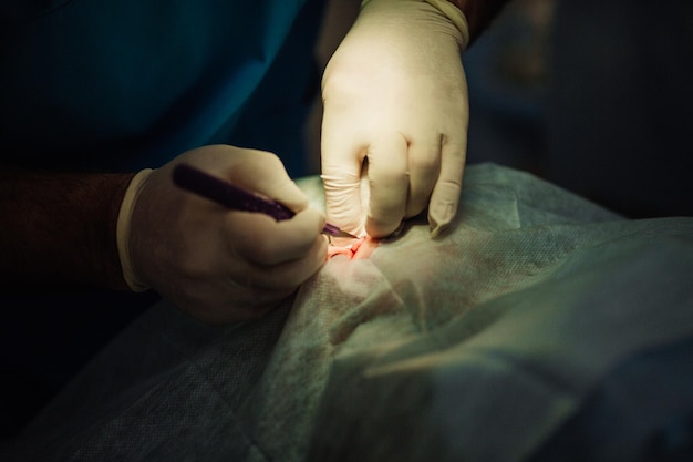 Chirurgo che mette su punti durante la chirurgia plastica estetica nella sala operatoria dell'ospedale