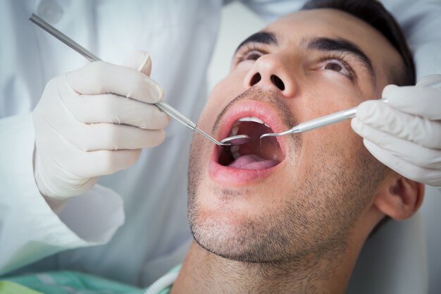 Chiuda in su dell&#39;uomo che ha esaminato i suoi denti