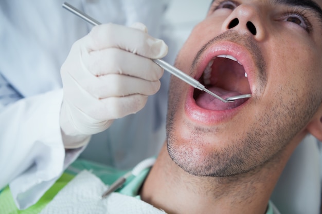 Chiuda in su dell&#39;uomo che ha esaminato i suoi denti