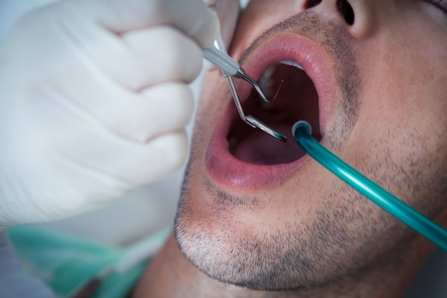 Chiuda in su dell&#39;uomo che ha esaminato i suoi denti