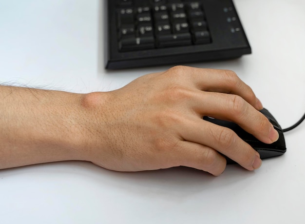 Cisti gangliare sulla mano dell'uomo Mano che tiene il mouse del computer