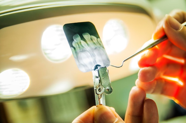 Close-up di un dentista che tiene in mano un'immagine a raggi X in una clinica medica