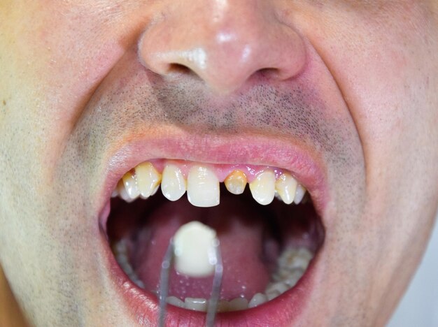 Close-up di un uomo che tiene i denti
