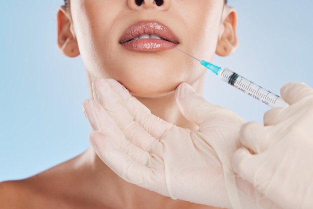 Collagene di bellezza e una donna che riceve un'iniezione alle labbra da un operatore medico Chirurgia plastica filler dermico e trattamento cosmetico per i giovani Medicina moderna cura della pelle e trucco per un bell'aspetto naturale