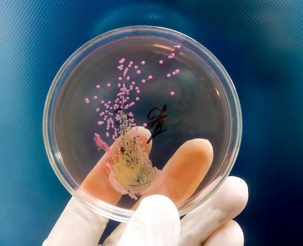 Coltura di feci su piastra di Petri con una colonia di batteri