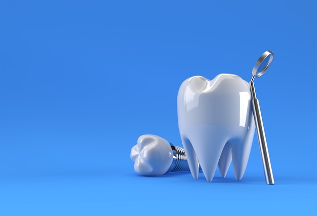 Concetto di chirurgia degli impianti dentali 3D Rendering.