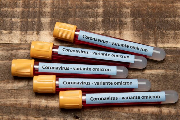 Concetto di coronavirus e diabete con tubo di raccolta del sangue e dispositivo di misurazione del glucosio, con variante di coronavirus di testo omicron in portoghese