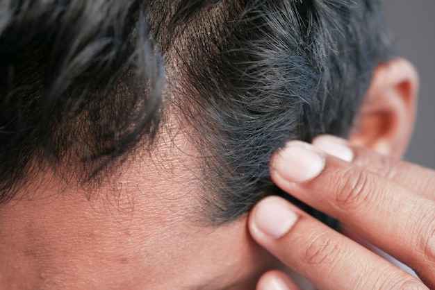 Concetto di perdita di capelli con l'uomo che controlla i suoi capelli