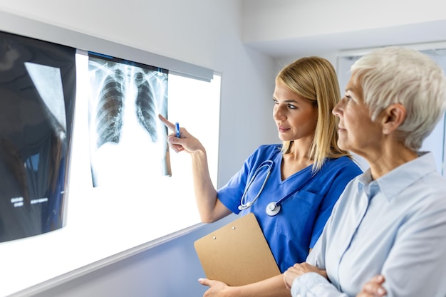 concetto di radiologia e medicina medico che spiega i risultati della scansione polmonare sullo schermo al paziente anziano