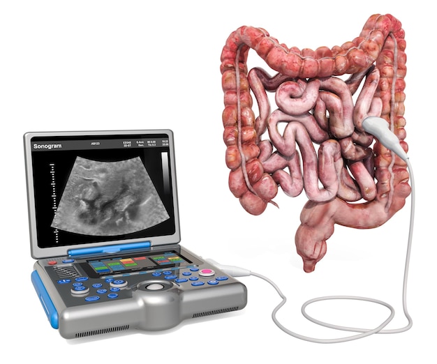 Concetto di ultrasuoni digestivi Intestino umano con macchina diagnostica ecografica medica rendering 3D