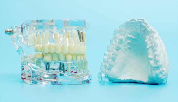 Confronta il modello del dente e il modello del dente con il filo metallico dentale