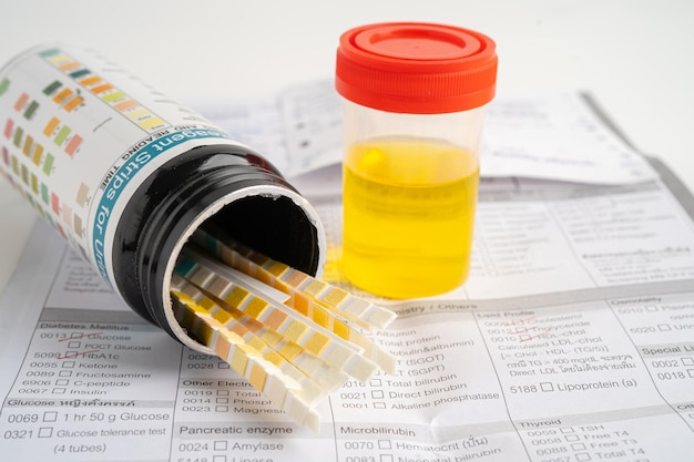 Coppa di urina per l'analisi dell'urina con striscia di reagente, test del pH su carta e tabella di confronto in laboratorio