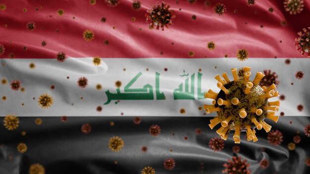 Coronavirus influenzale che fluttua sulla bandiera irachena, agente patogeno che attacca le vie respiratorie