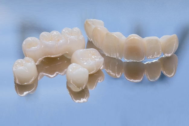 Corone dentali in ceramica senza metallo. Zirconio ceramico nella versione finale. Colorazione e smaltatura. Design di precisione e materiali di alta qualità