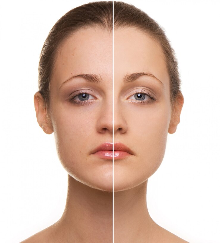 Correzione del viso della donna