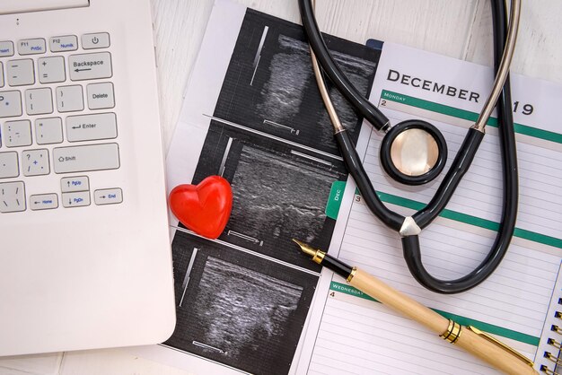 Cuore rosso con stetoscopio e risultati dell'analisi sul tavolo