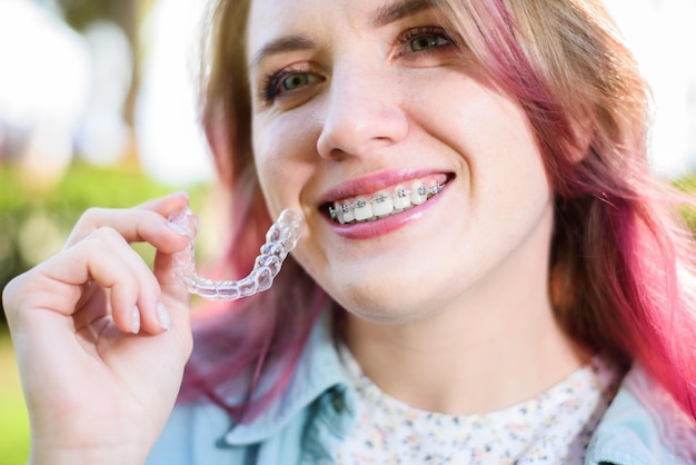 Cure odontoiatriche Una ragazza sorridente con l'apparecchio ai denti tiene in mano gli allineatori e mostra la differenza tra loro