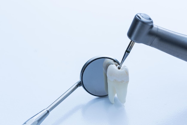 Dental rimuove la carie dal dentista con il trapano